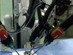 robot da vinci (radio-canada Â©)