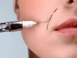 jpg_la_chirurgie_esthetique_en_suisse_article.jpg