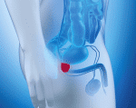 prostate.png